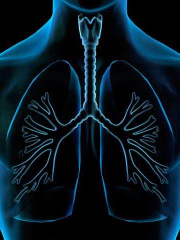 肺部x线图
